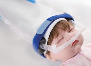 Bubble CPAP - Nasal Cannula
